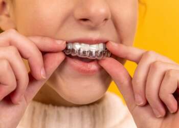 clear correct aligner clear correct aligner